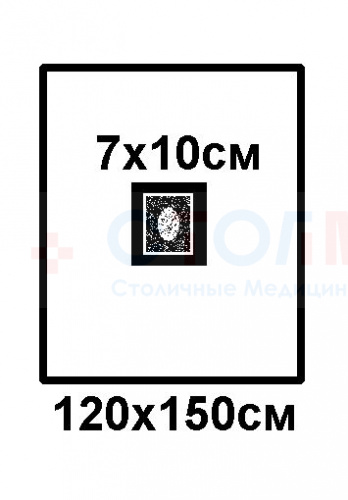 Простыня хирургическая с отверстием адгезивная 150x120cм (вырез 7х10см) стерильная фото 2